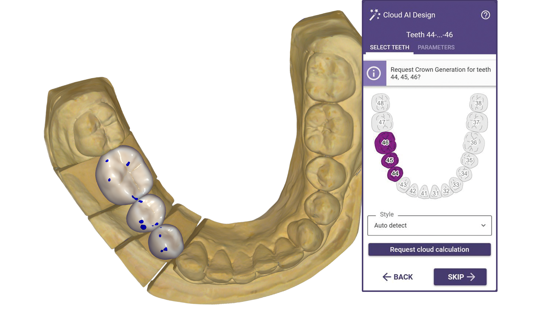 DentalCAD AI-assisted multi-unit design